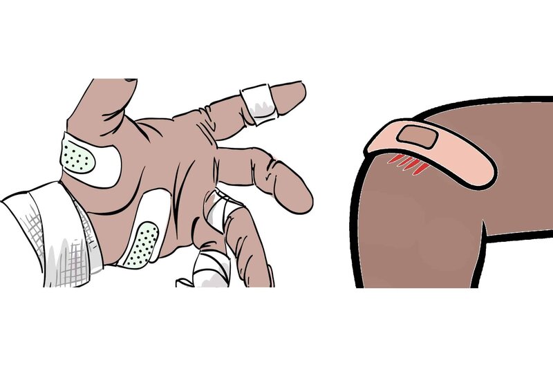 A collection of small injuries referred to in the story.