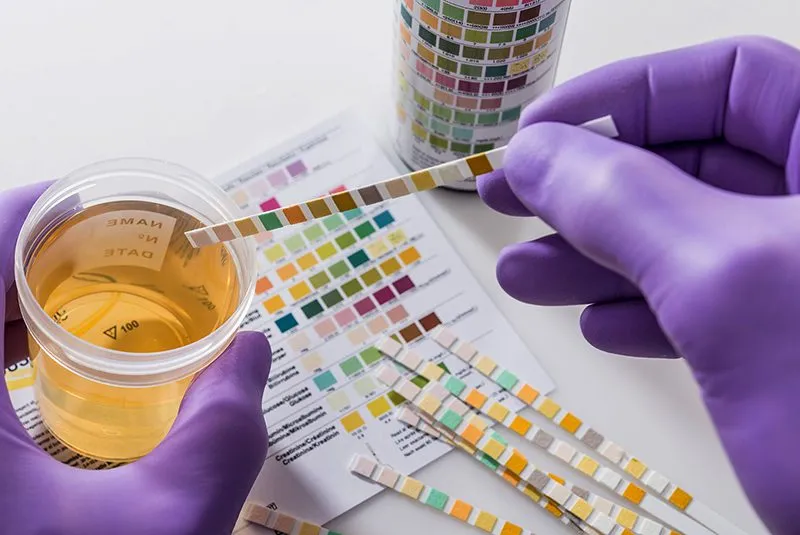 Preparing for a 9 Panel Drug Test