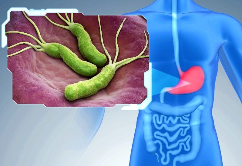 Навіщо визначати стійкість Helicobacter pylori перед лікуванням