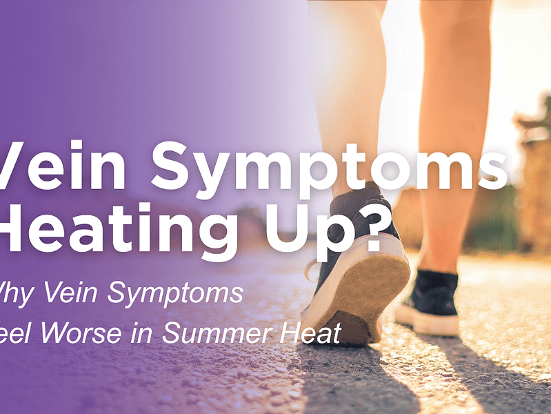 Why Vein Disease Symptoms Often Peak in Mid-Summer