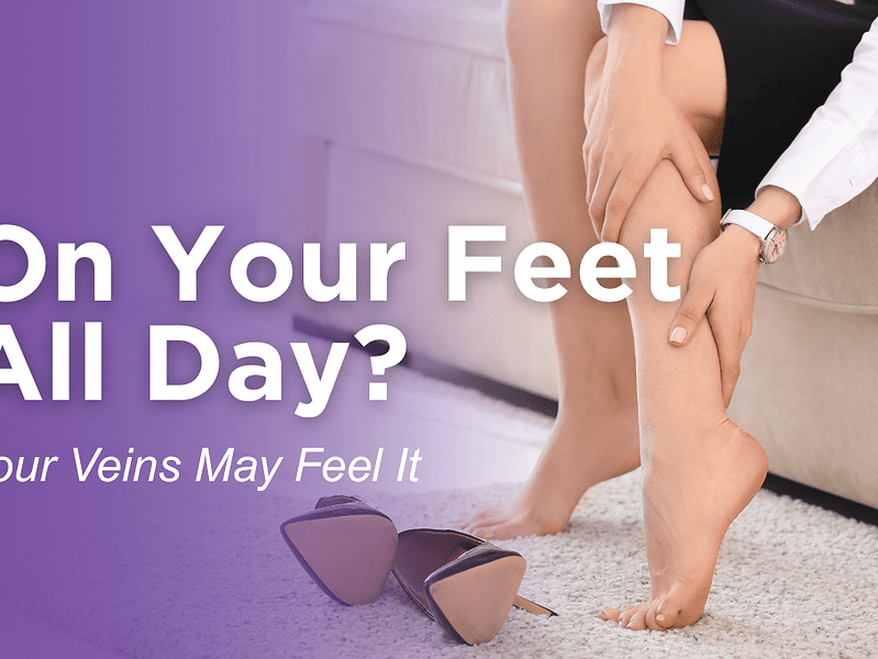 Standing All Day on Your Feet? How Work Habits Impact Vein Health