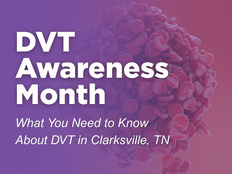Blood Clot Awareness in March: What You Need to Know About DVT in Clarksville, TN