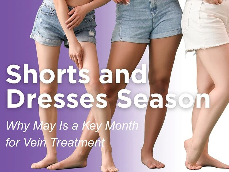 Thinking About Shorts and Dresses? Why May Is a Key Month for Vein Treatment