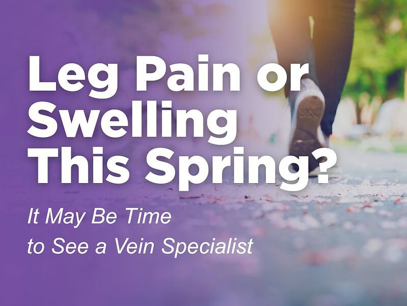 Leg Pain or Swelling This Spring? It May Be Time to See a Vein Specialist in Augusta, GA