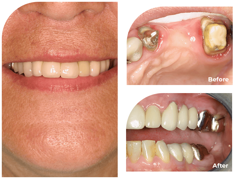 Patient-1000-collage