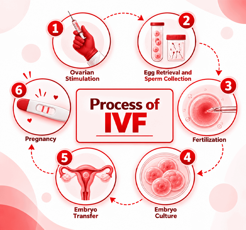 Process of IVF at Imprimis IVF Centre, Srinagar