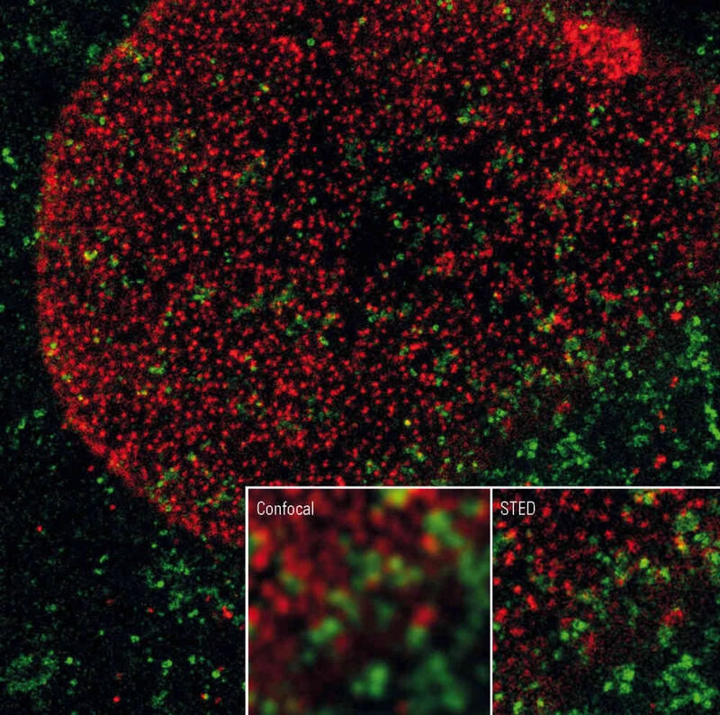 Immunofluorescence staining in HeLa cells: red: NUP 153, green: Clathrin-TMR. gSTED with 0% 3D STED - ©Leica