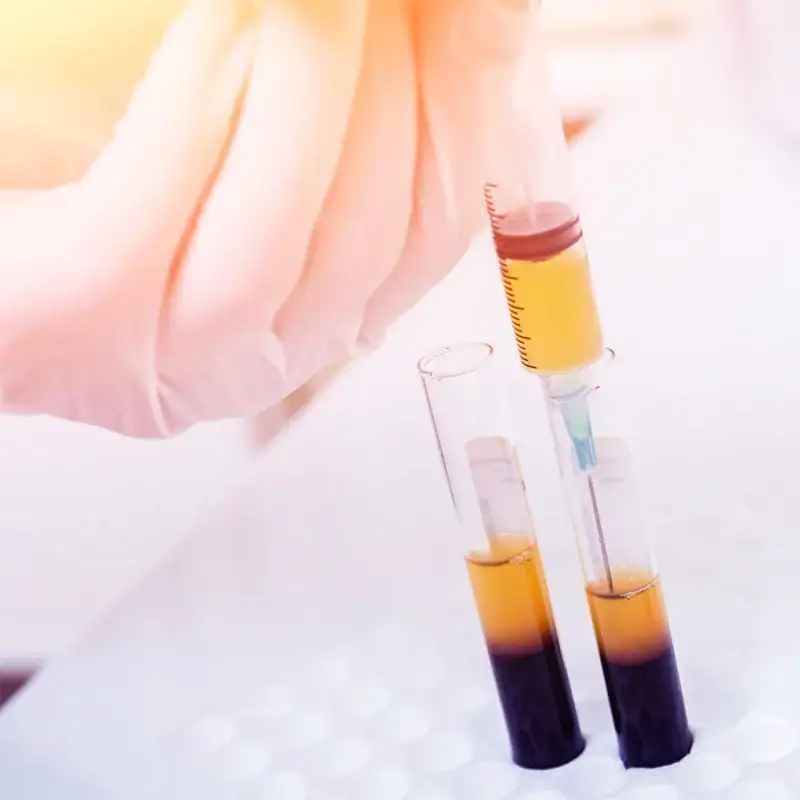 Patient receiving regenerative medicine therapy at BionwoRx, Center for Functional and Regenerative Medicine in Carmel, Indiana, promoting natural healing and joint restoration.