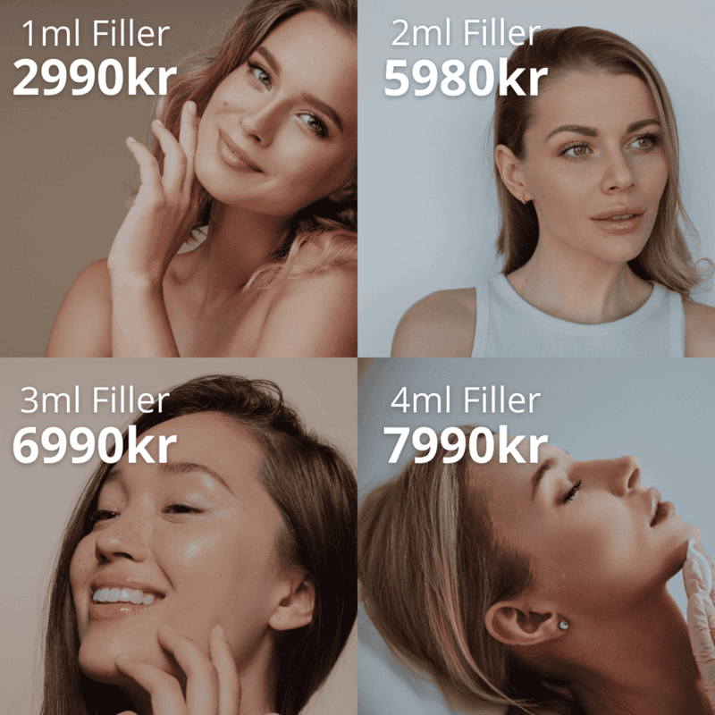 Fillers kampanje