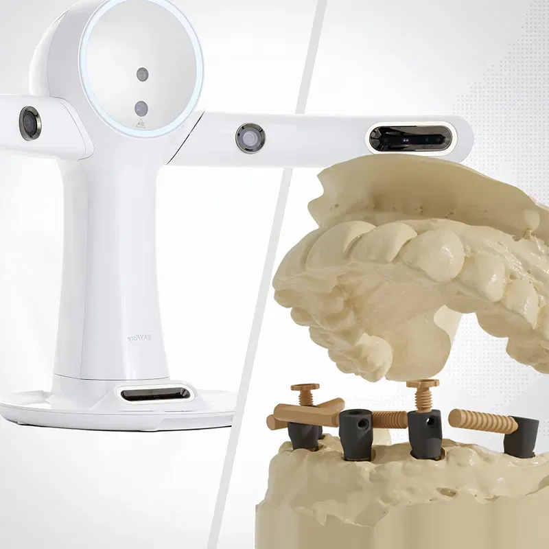 Avancée dans le traitement implantaire All-on-X