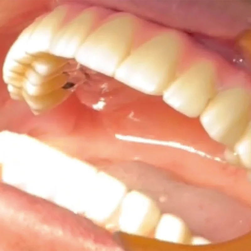 Labocast3d_eletra-hat-0