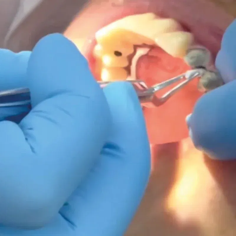 Labocast3d_eletra-hat-3