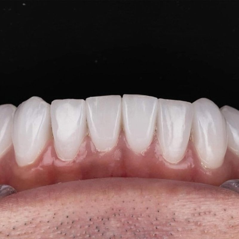 set up 1600px zirneer (4)-min