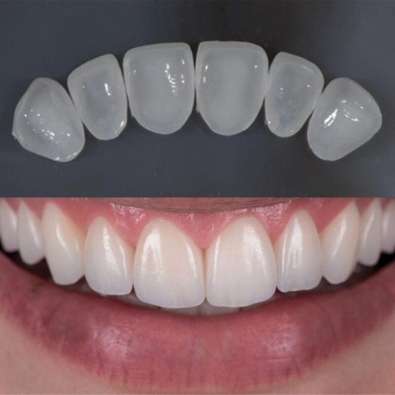 set up 1600px zirneer (7)-min