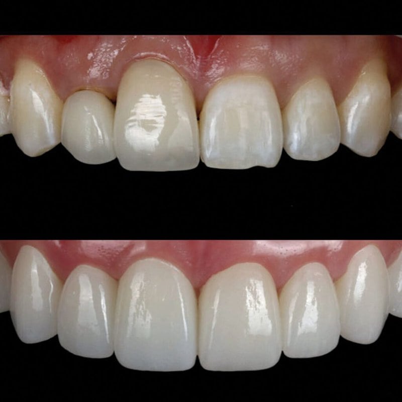 set up 1600px zirneer-min