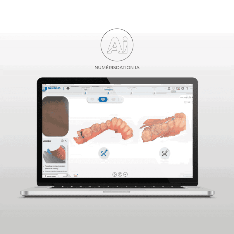 Shining3D_AoralScan_Wireless_Bloc-1_04-min