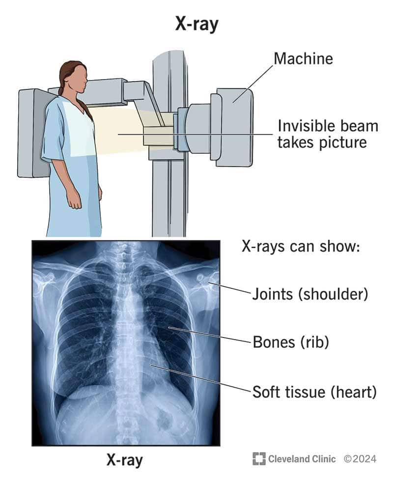 X ray near me
