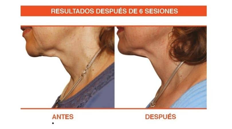 resultados-venus-viva-WA001421 Resultados Venus Viva