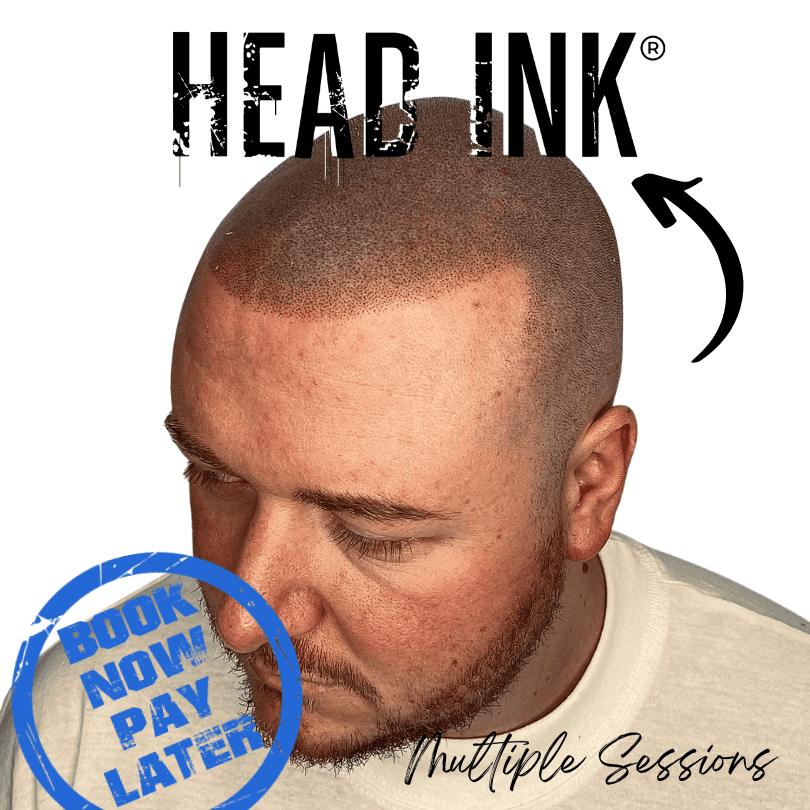 man with Scalp micropigmentation