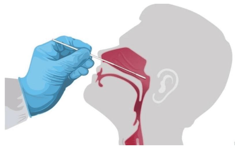 Covid-19: Swab test or antibody test – which is better?