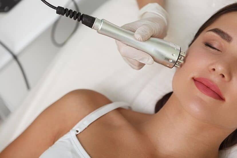 radiofrecuencia-facial-vitali-beauty