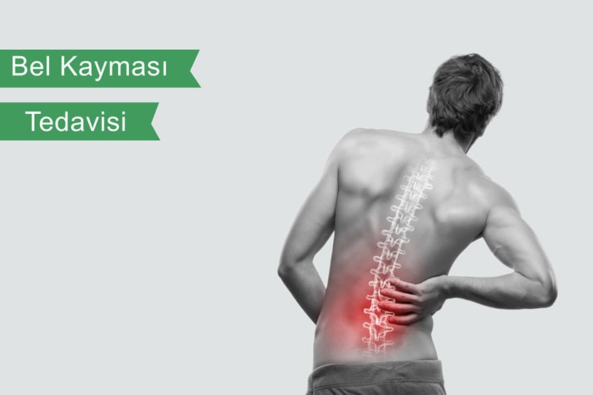 Bel kayması