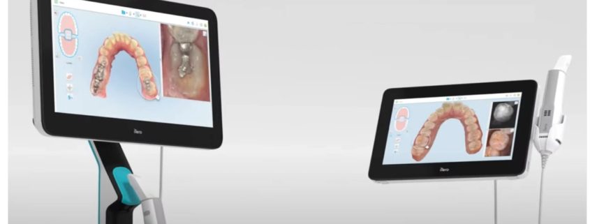 iTero Element Plus Series intraoral scanners — cart and mobile configurations used at Frangella Dental for Invisalign, crowns, and lab work