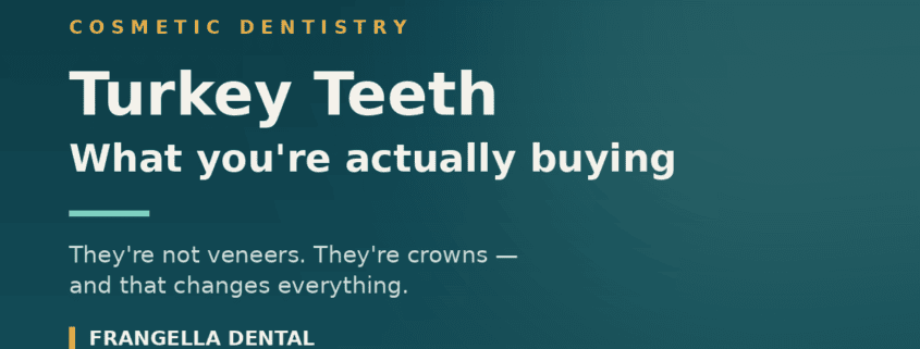 Turkey teeth explained: they're not veneers, they're crowns — and that changes everything. Frangella Dental, New York City cosmetic dentistry.