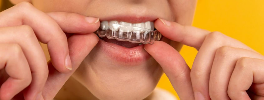 Woman demonstrating a transparent dental aligner, illustrating Invisalign treatment options and costs in NYC