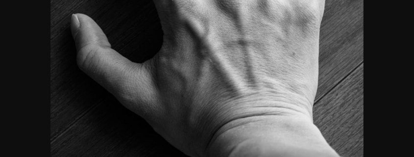 Ganglion cyst hand wrist surgery Austin TX ATX Orthopedics