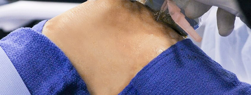 Knee injection procedure for pain control