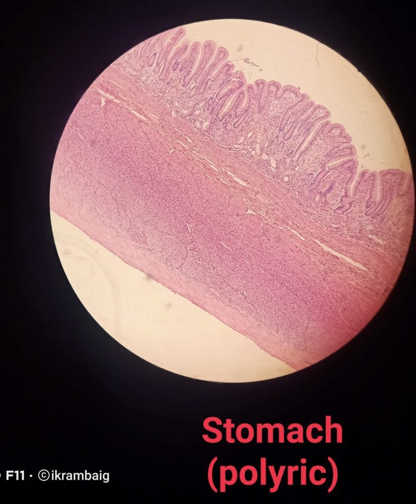 Stomach Pyloric,Cardiac and Fundic Histology Slide ID Points