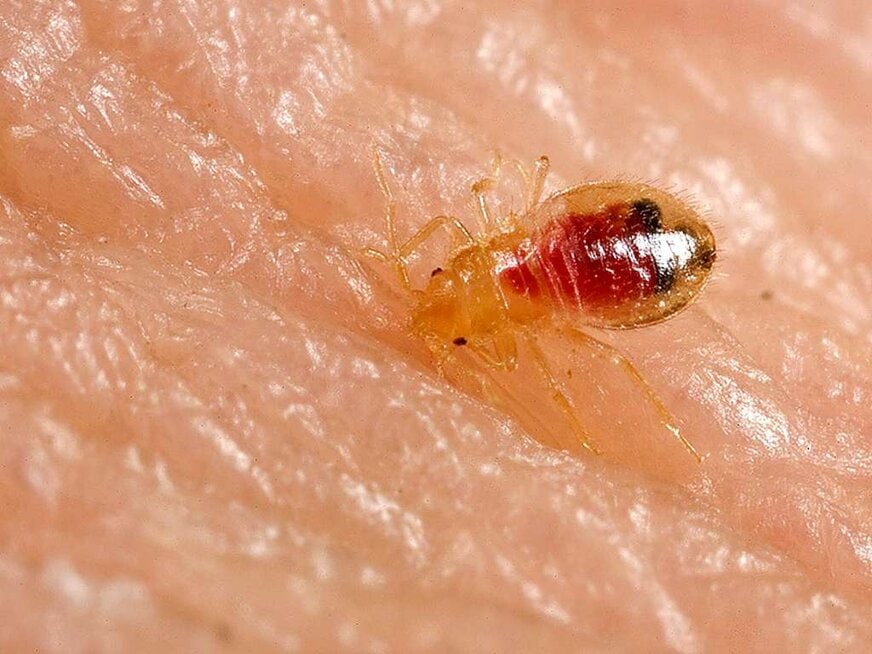 what are the first signs of a bed bug infestation?