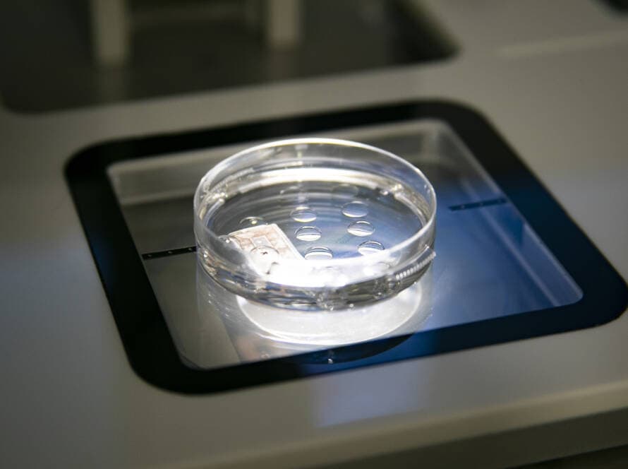 Congelar Ovulos en Colombia