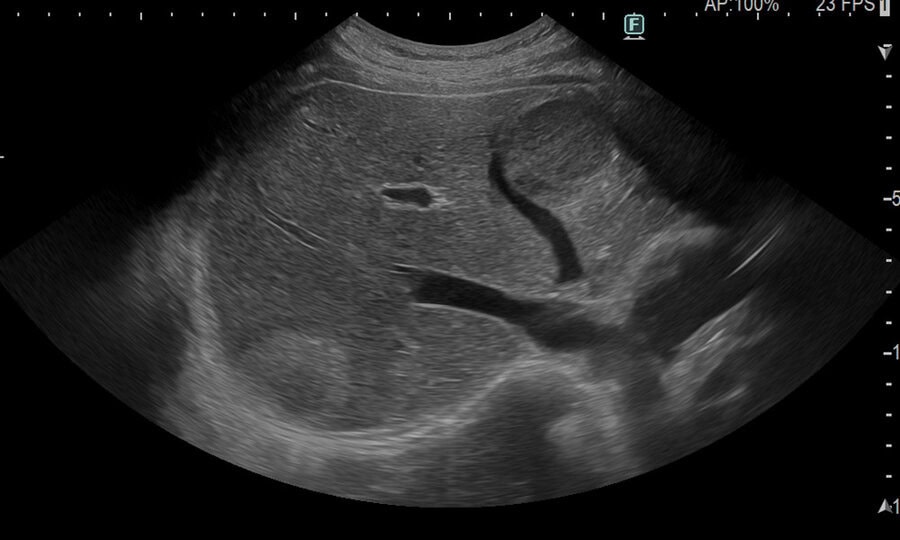 Ecógrafo Arietta 850 Dix - Image 6