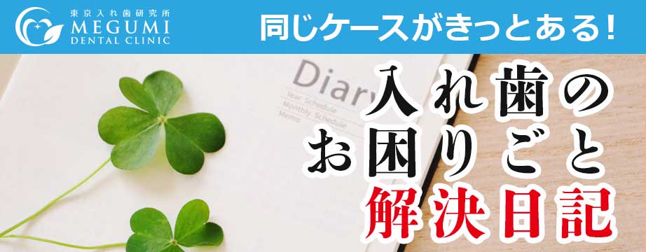 入れ歯のお困りごと日記｜アート歯科