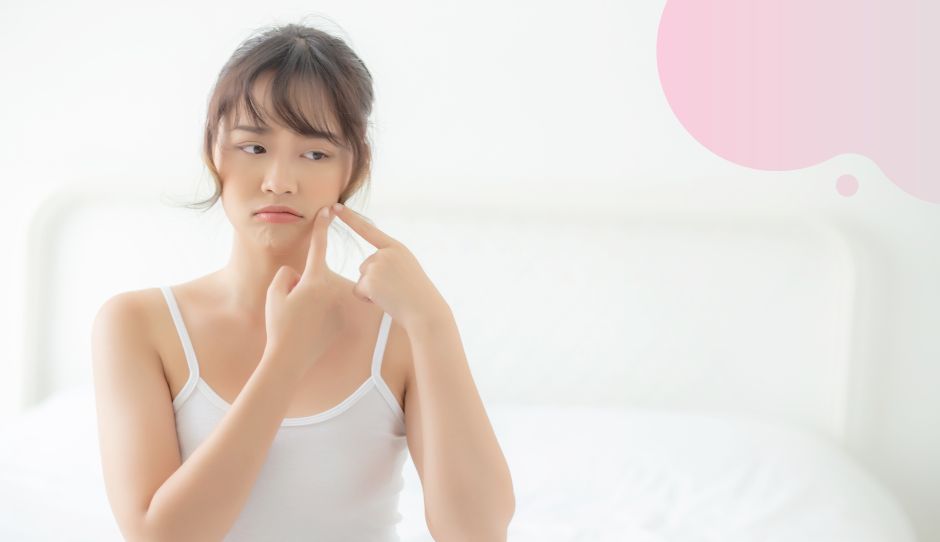 ニキビ内服セット・治療方法・料金