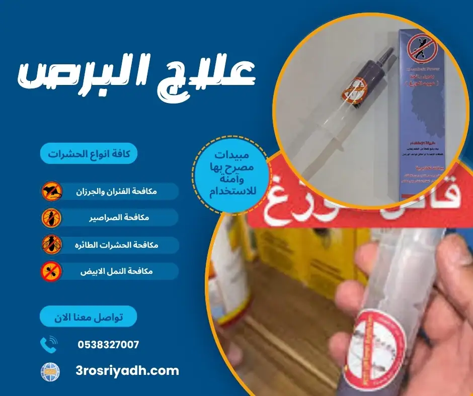 علاج البرص