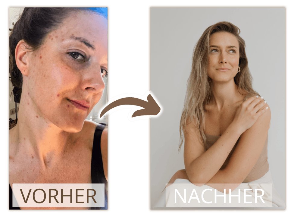 Vorher Nachher Vergleich Haut - Bridget Barth - WandelPur - Hautbalance Methode - Online Kurs - Tobias Steinhaeuser