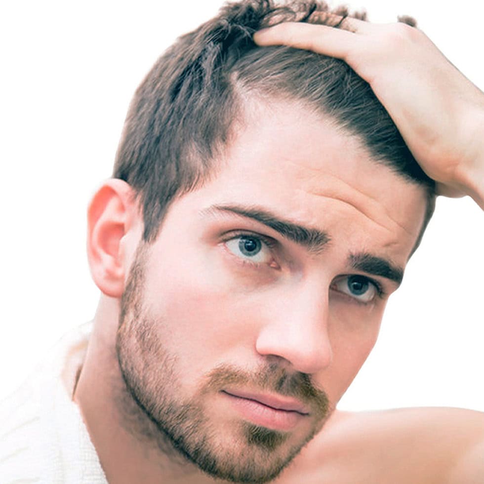 Hair Loss