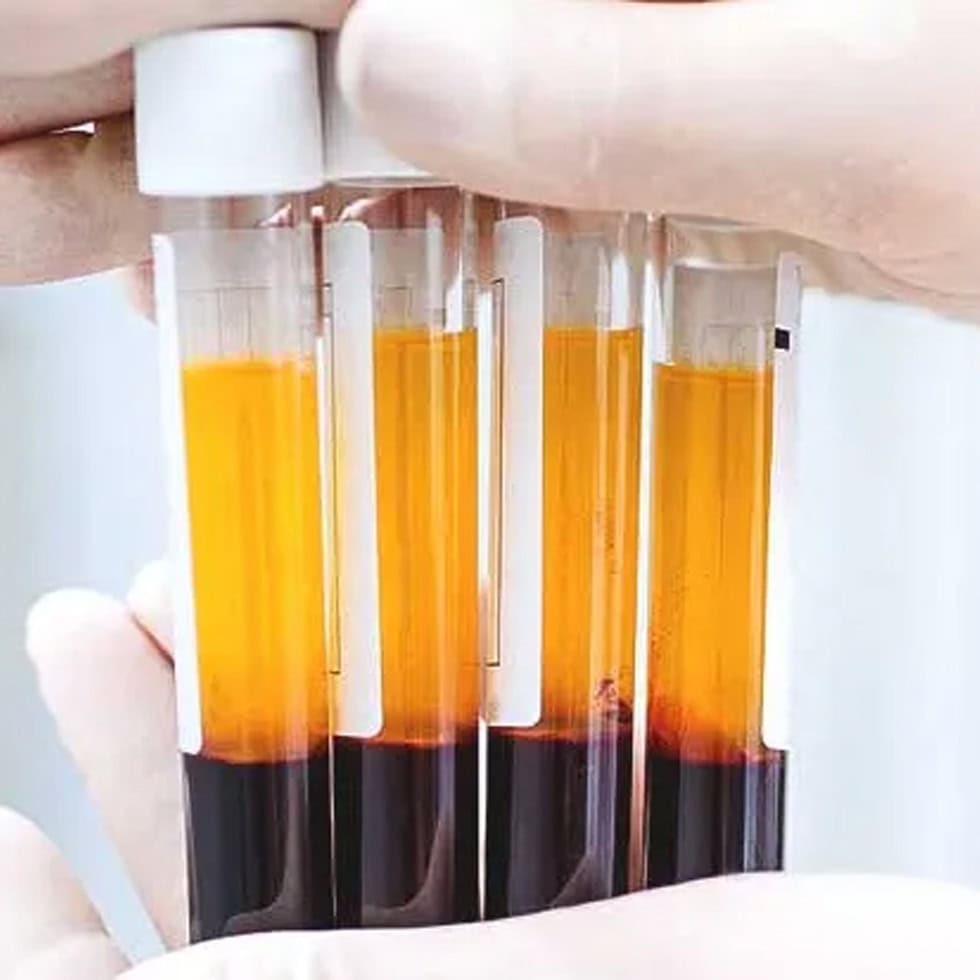 Extracellular vesicle therapy for regenerative healing at BionwoRx, Carmel, Indiana.