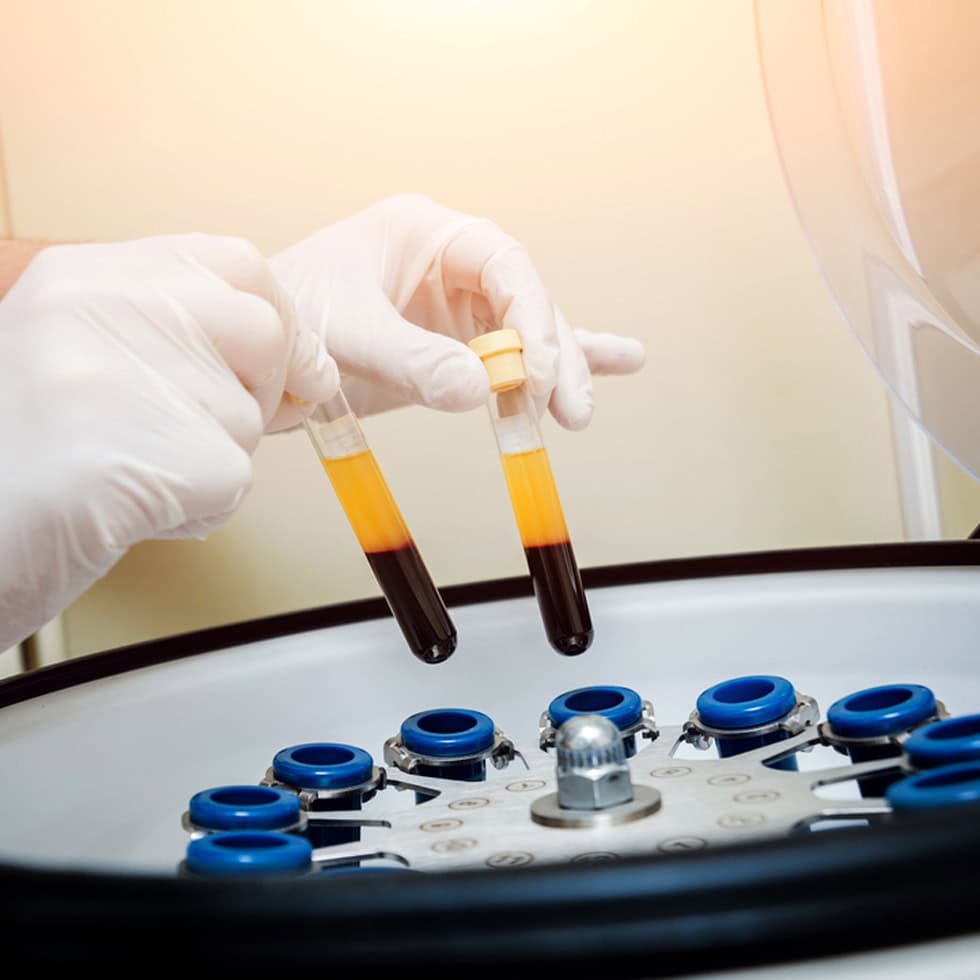 Platelet-rich plasma being separated from whole blood in a centrifuge for regenerative medicine treatment at BionwoRx.