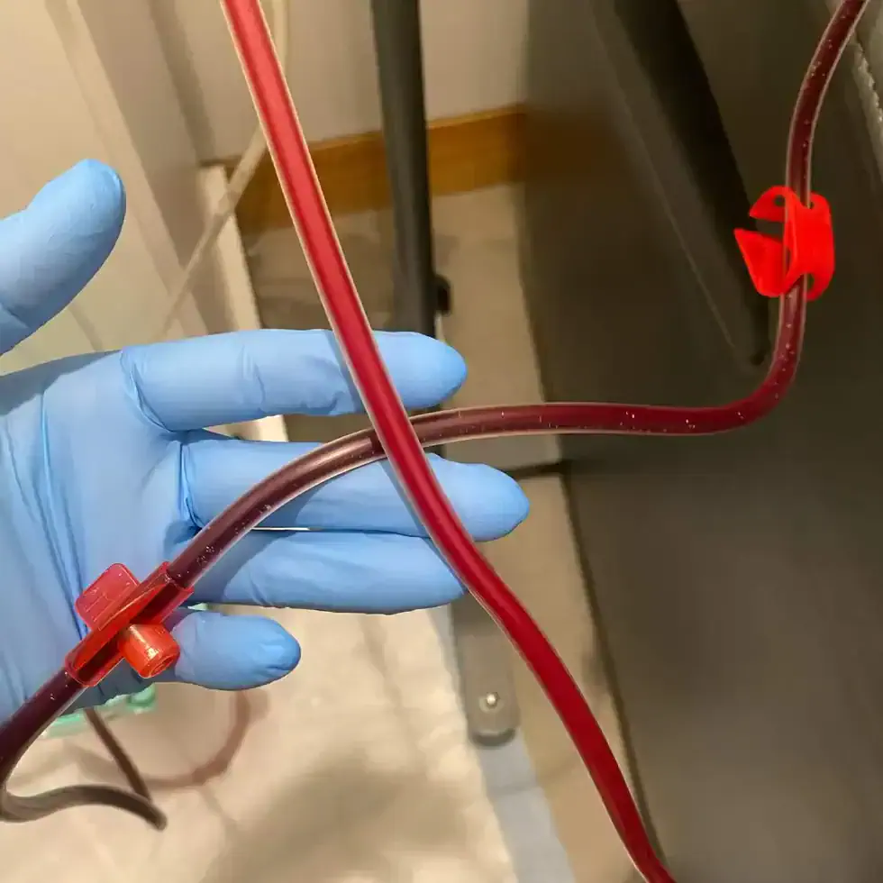 Side-by-side comparison showing EBO2 cleansed, oxygenated blood versus darker unfiltered blood during ozone therapy at BionwoRx in Carmel, Indiana