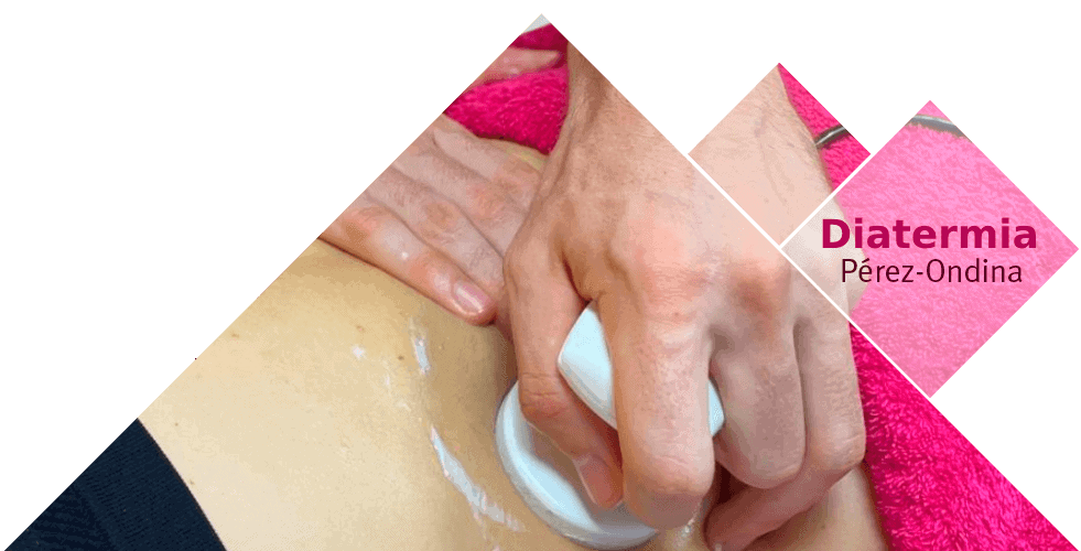 Tratamiento de diatermia en fisioterapia en Móstoles<br />

