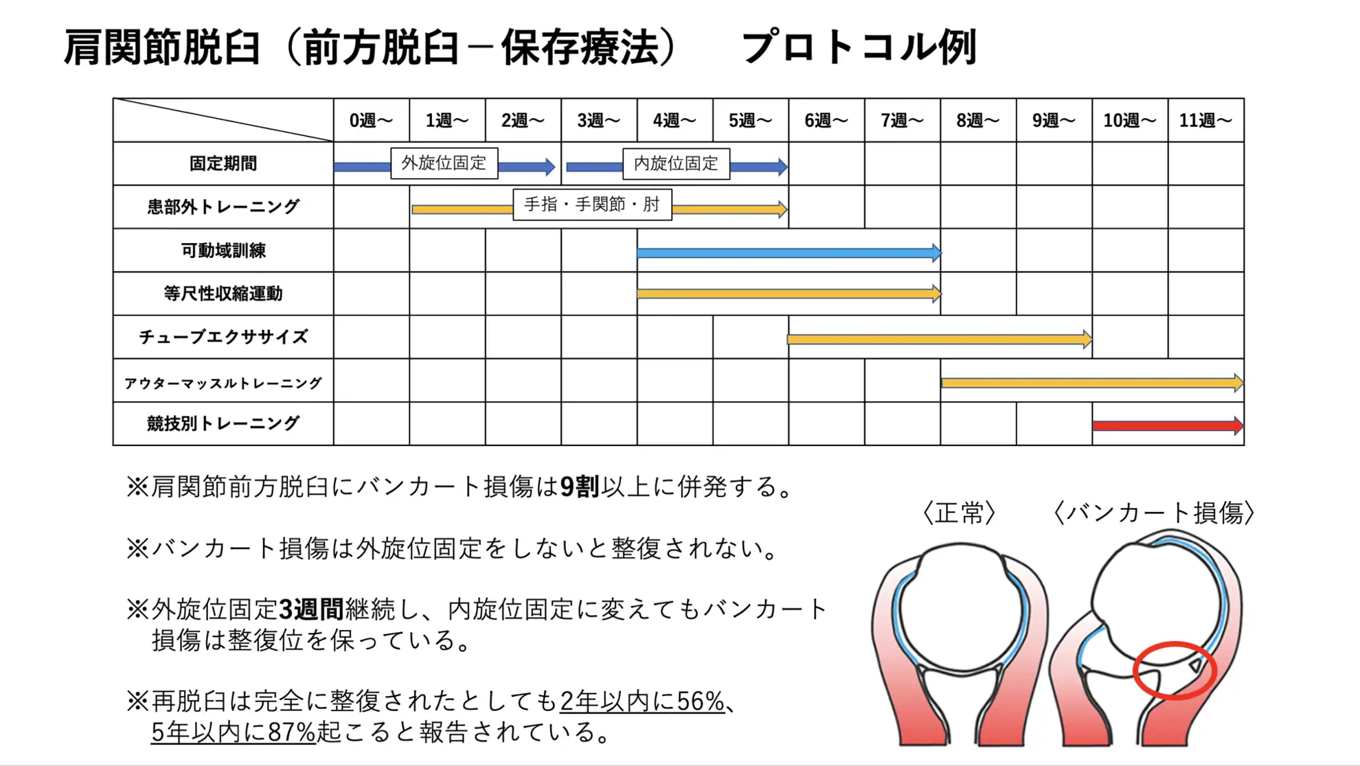 後方脱臼（肩峰下脱臼、棘下脱臼）
