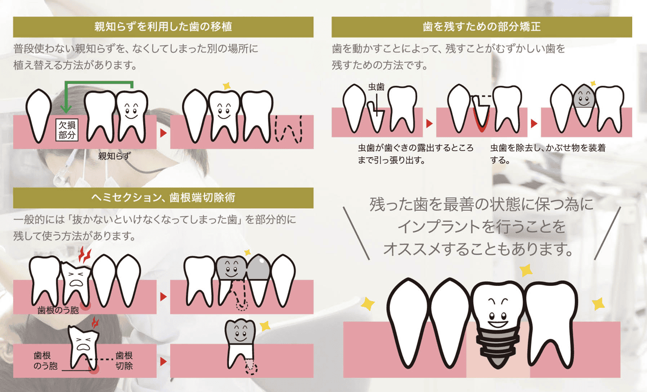 口腔外科について
