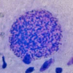 toxoシスト.jpg