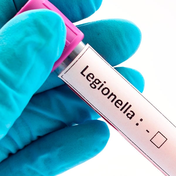 prueba legionella