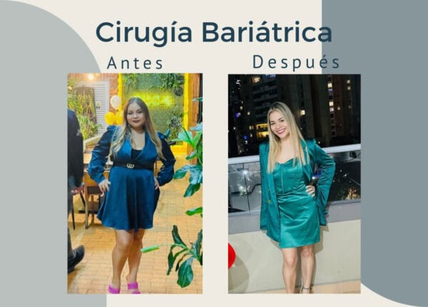 Cirugía Bariátrica. Antes y después.