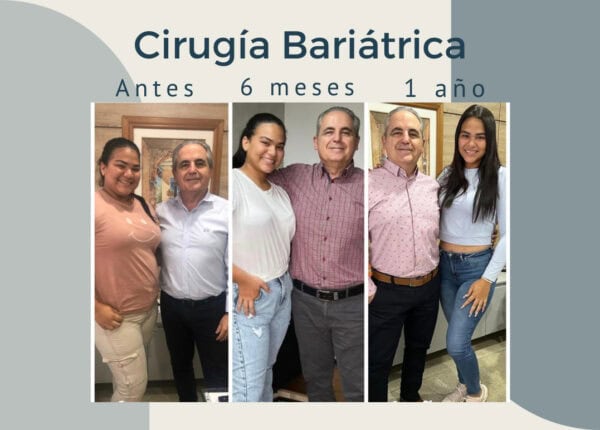 Cirugía Bariátrica. Excelente resultado.